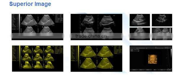 2016 new veterinary laptop ultraaouns machine with 3D function