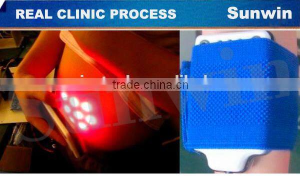 Best Cellulite fat removal machine with multi languages system