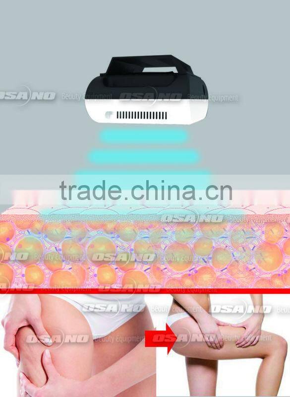 Portable Cryolipolysis machine &fresenius dialysis machine factory in china