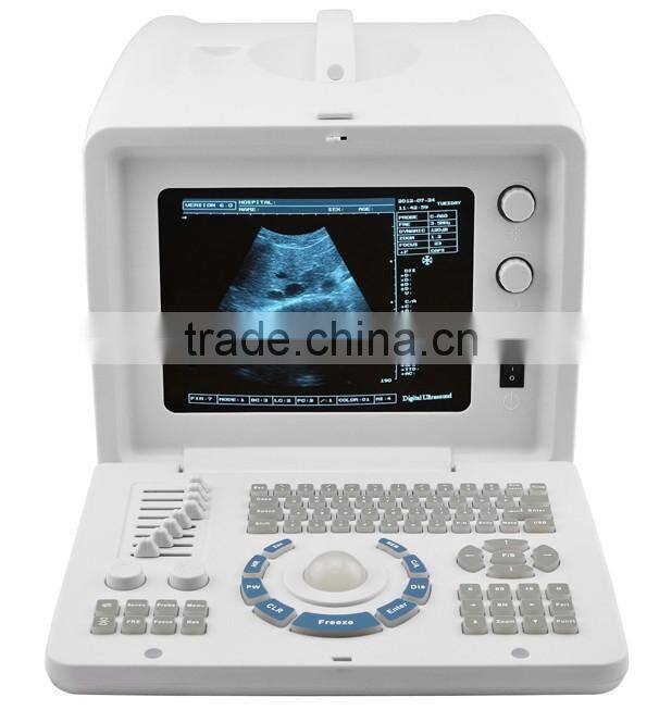 Cheapest Digital Portable Ultrasound Scanner RUS-6000D