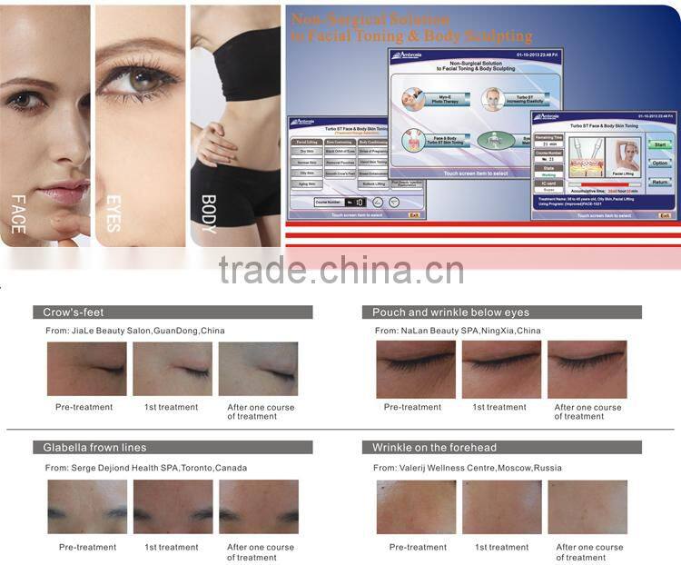 Best price beauty salon microcurrent facial lighting machine
