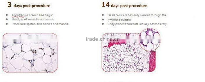 vacuum body shaper & skin cooler beauty equipment home use