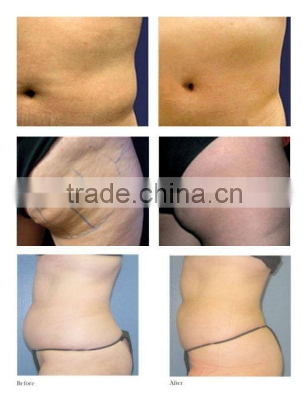 4 Heads portable ultrasonic cavitation+RF (S50B) CE/ISO slimming machine vacuum suction