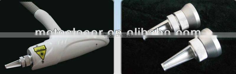 Q-switch laser removal tattoo on eyebrow