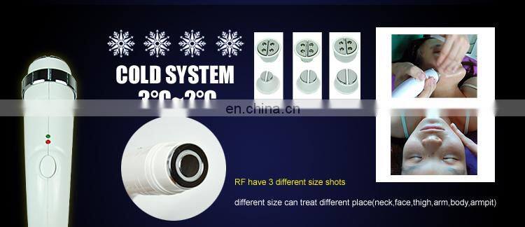 Acne removal ipl hair removal machine shr elight+rf skin lifting machine