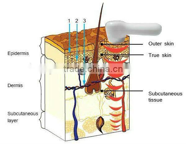 VY-628C Ultrasonic beautiful instrument,ultrasonic beautiful machine,ultrasonic beautiful equipment