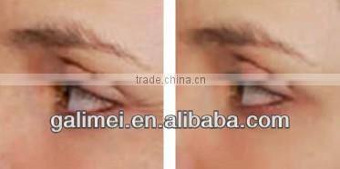 Home use Auto Micro Needle Device with CE