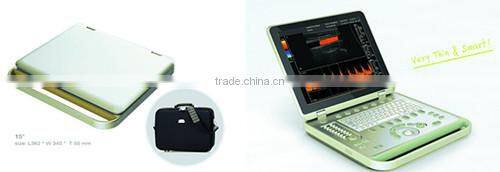 New design artery doppler equipment made in China