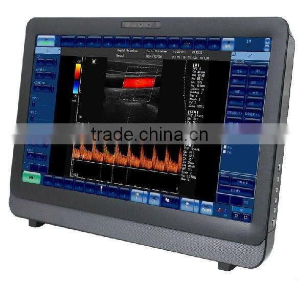 Medical color doppler Ultrasound Diagnostic System, color doppler ultrasound