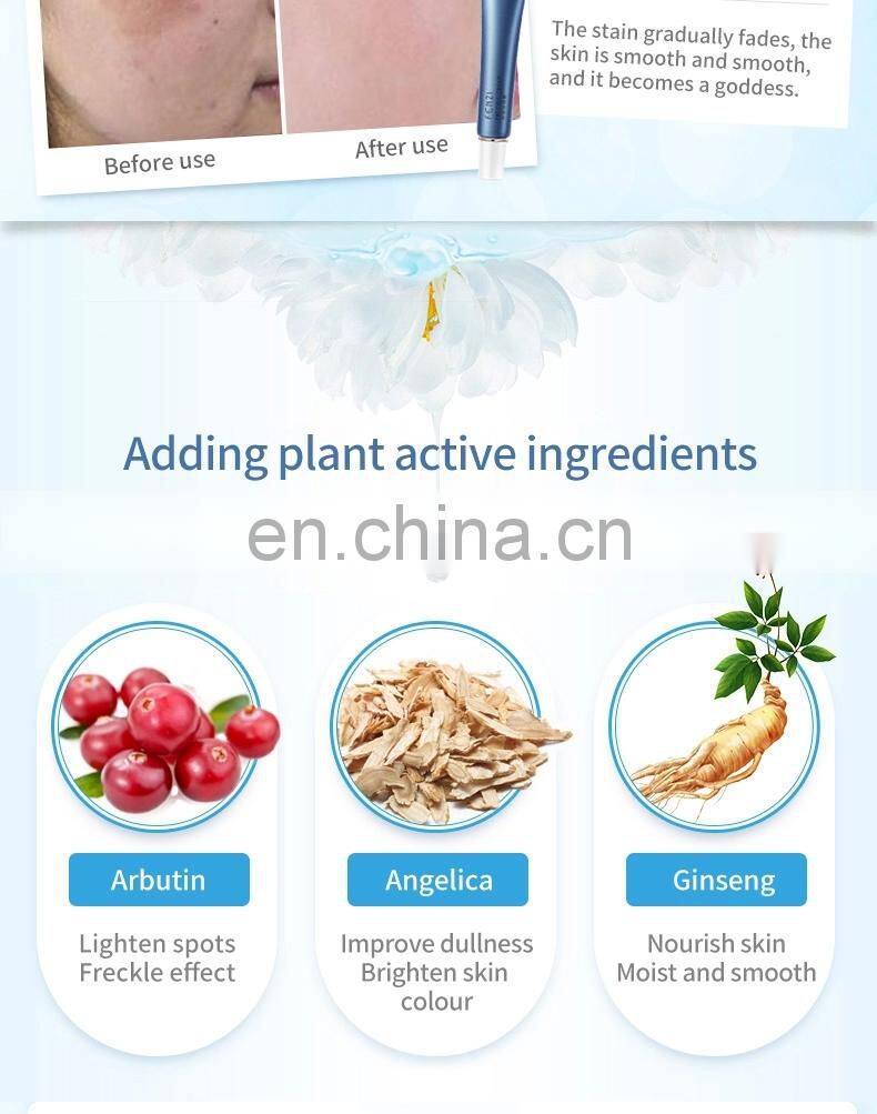 Professional Skin Care Face Cream Freckle Cream For Face