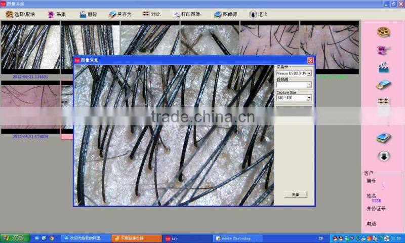 skin analyzer iris recognition machine