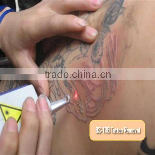 100% effects tattoo removal effects fda approved tattoo removal lasers