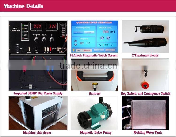 Good feedback tattoo removal q-switch nd yag laser