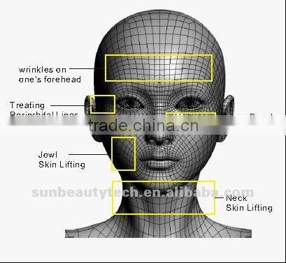 3 in 1 Cavitation & RF Slimming Beauty Machine