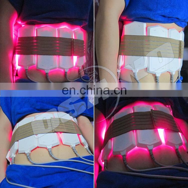 Business Opportunity Dual Wavelength 650nm And 980nm Smart Lipo Slim Machine