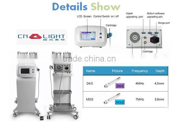 2016 hot selling ultrasonic Hifu vaginal tightening machine