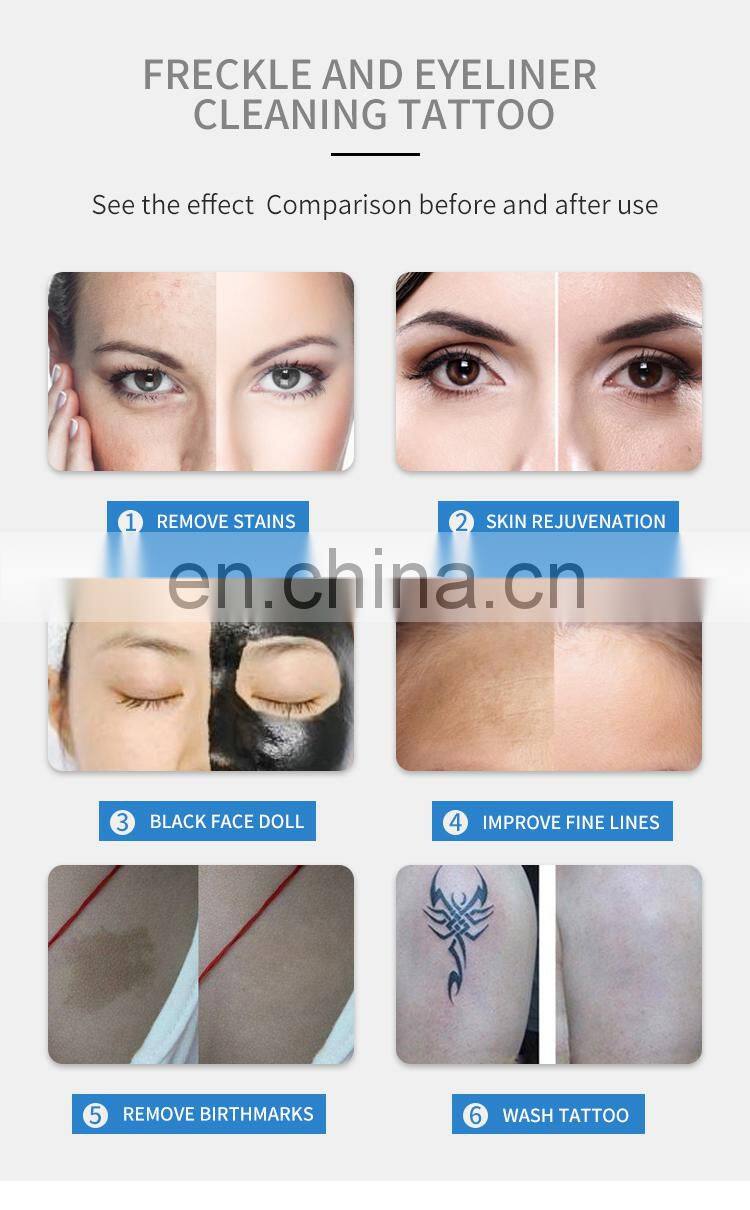 Factory ND Yag Laser Machine Professional Tattoo Removal Laser Instrument Eyebrow Pigment Removal Beauty Machine