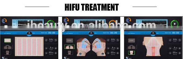 2015 Focused ultrasound fat reduce Hifu slimming system
