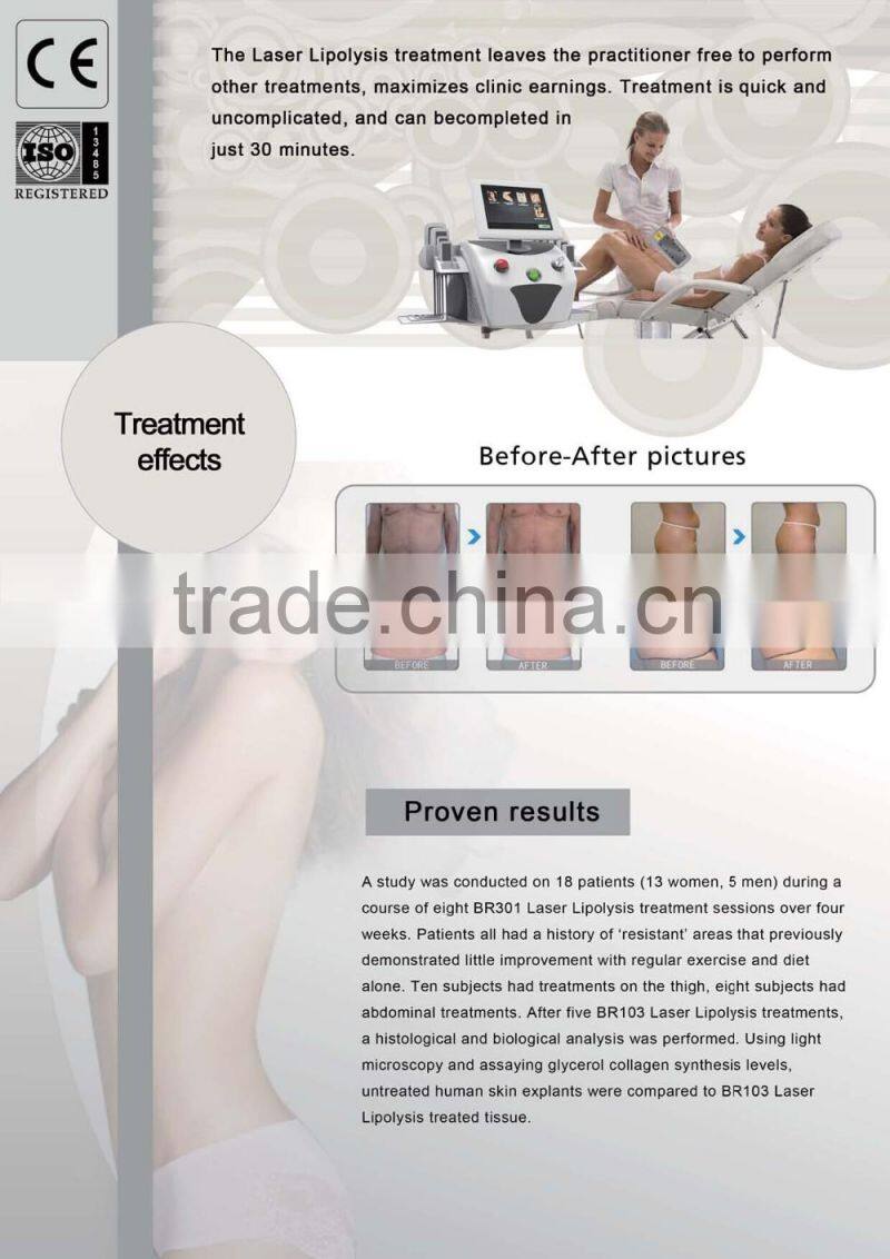 Portable 650nm lipo laser/i-lipo machine for sale