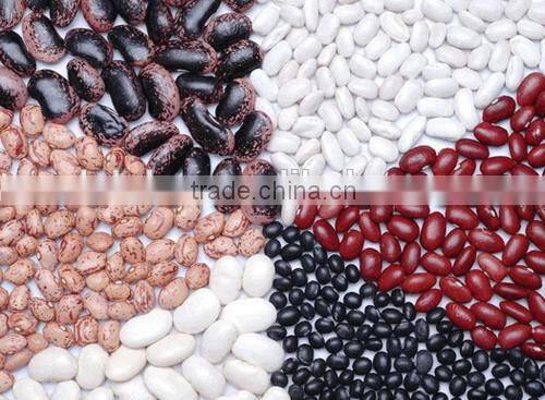 China new crop good quality light speckled Pinto Kidney Bean