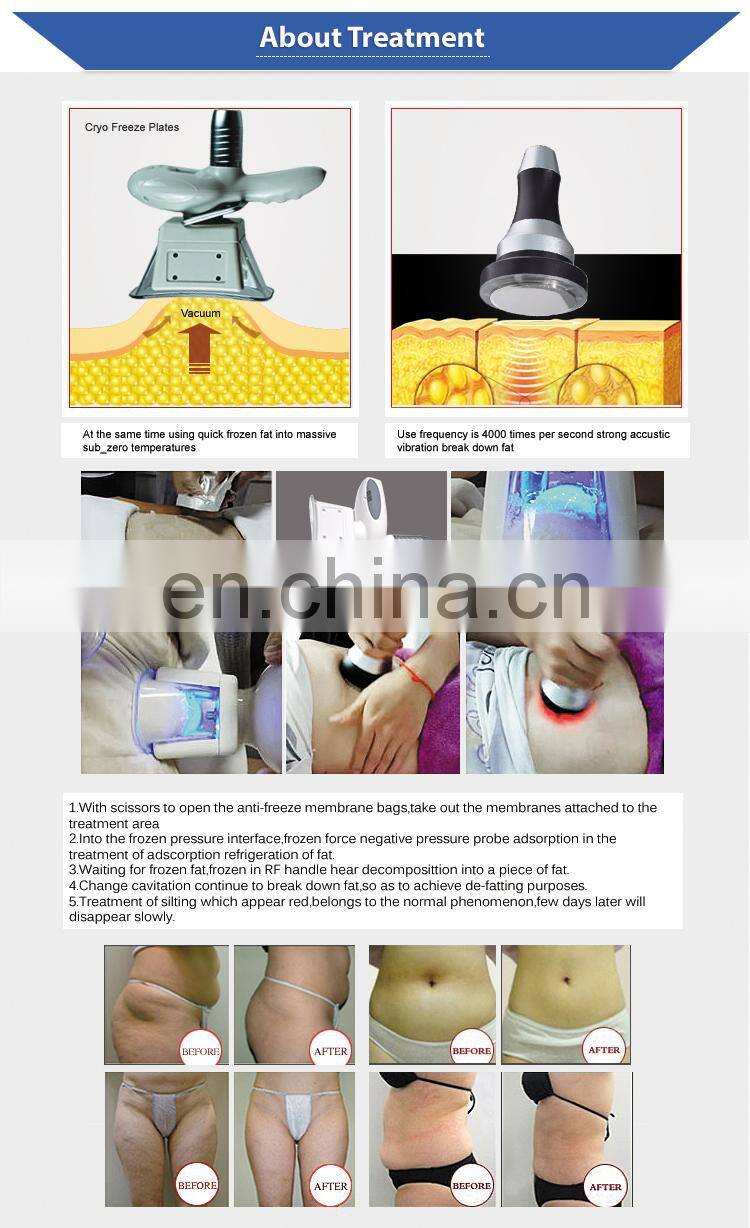 4 cryo handle freeze fat ice cooling slimming machine for sale factory price