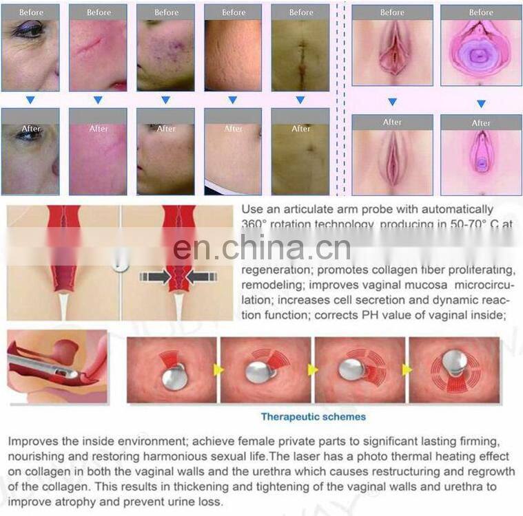 Salon Clinic Equipment Co2 Fractional Laser