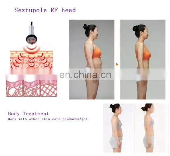 2 In 1 RF Biopolar Skin Tightening Beauty Machine for Skin Lifting Wrinkle Removal Anti-aging Device