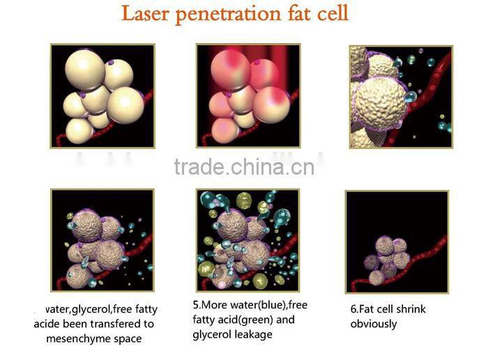 Lipolaser shaping machine / 528 diodes laser / best 4D laser BR216