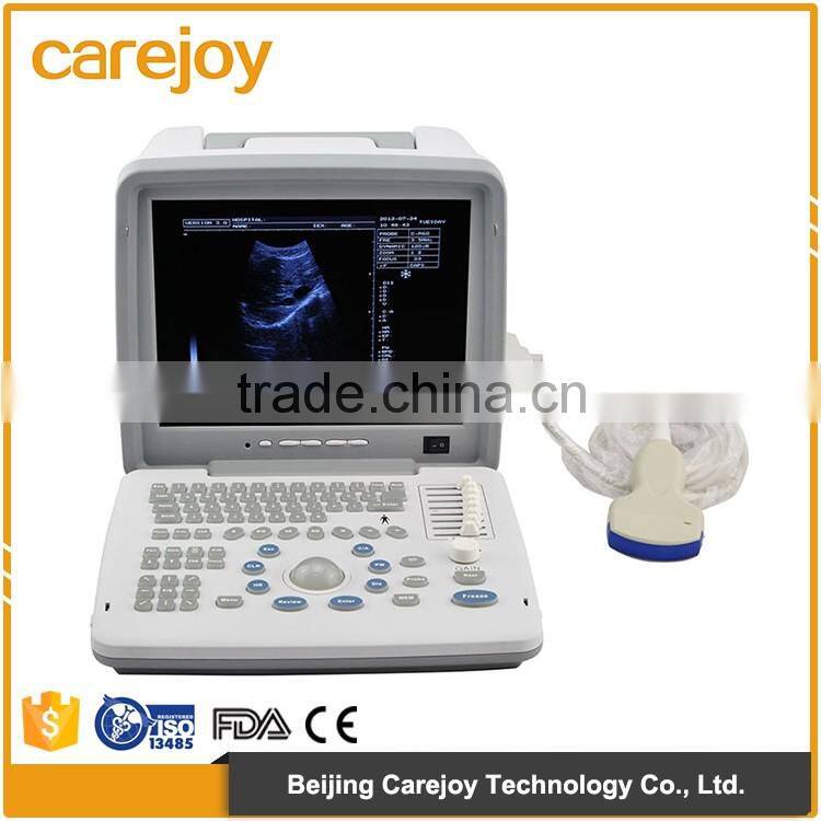 High Quality Ultrasound Machine Medical equipment ultrasound machine portable
