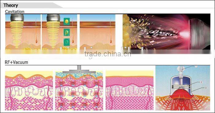 Hot selling CE TUV approved 5 in 1 weight loss slimming cavitation rf vacuum ultrasound machine parts