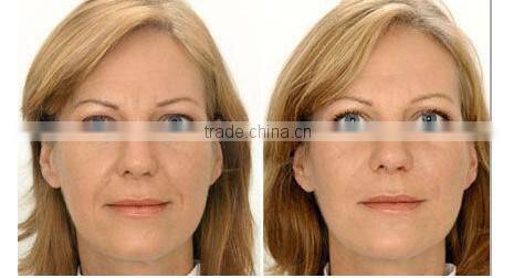 GD-11Professional diamond peeling mircodermabrasion beauty machine