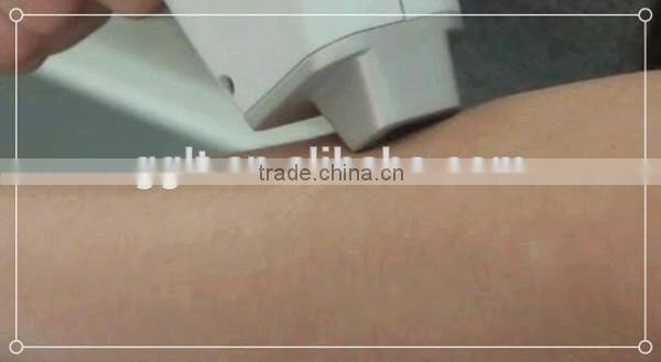 Popular portable 808 diode laser hair removal equipment spa saloon equipments