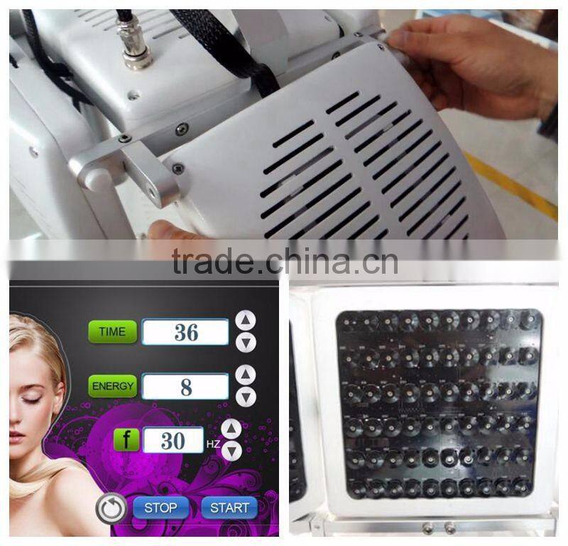 Mitsubishi Diode laser the best treatment for hair loss laser hair regrowth