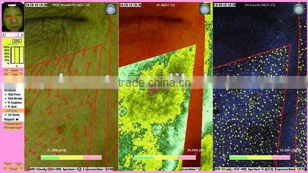 WT-03-B Big Facial Skin Analyzer Magic Mirror