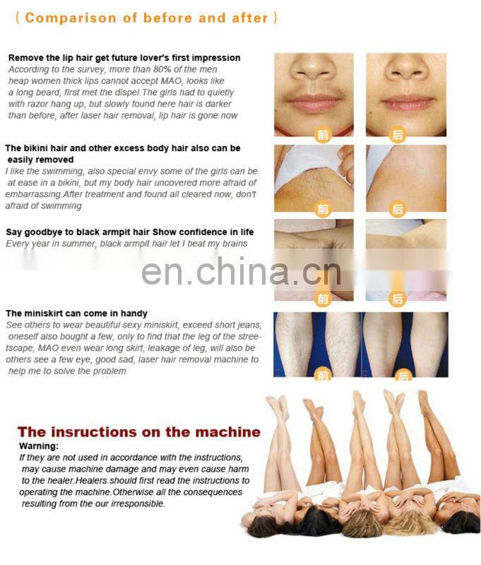 Just take it! RL-A808! smooth away vibe hair remover