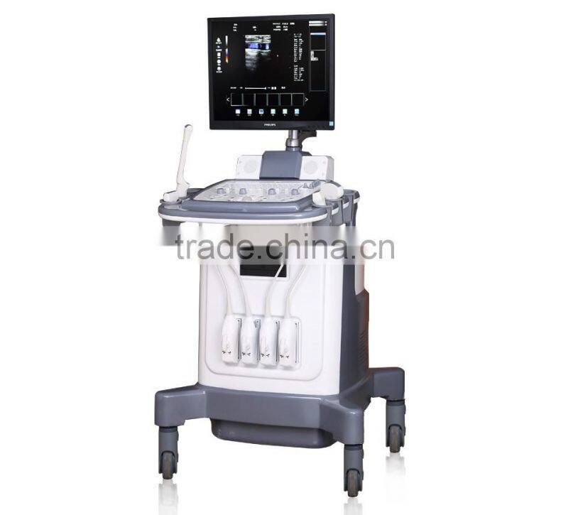 Echo Color Doppler 3D Function Laptop/Notebook Ultrasound