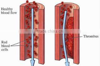 BNP Supply 100% Natural Resveratrol Capsules/Giant Knotweed Extract Capsules