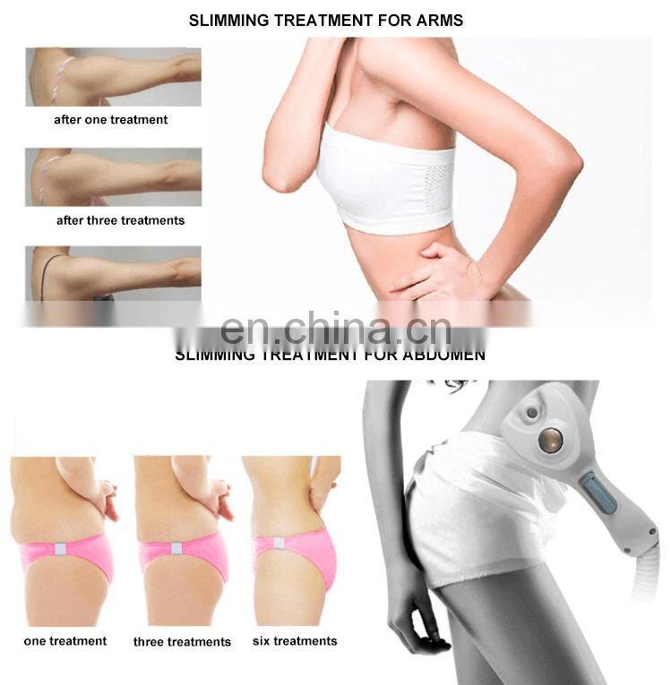 Painless Ultrasonic RF Skin Rejuvenation/ Fat Burning Salon Beauty Machine