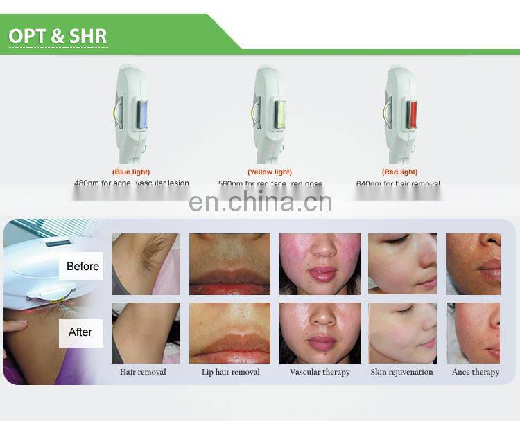 Double handpiece IPL RF E light OPT hair removal machine with big spot size