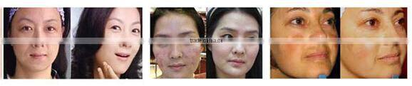Wholesale home use 3 colors skin led face mask for skin rejuvenation