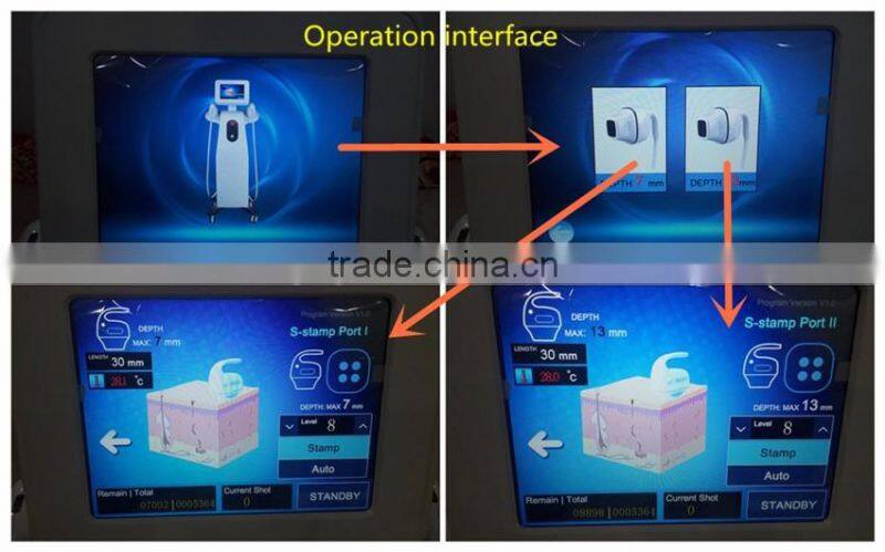 HIFU beauty machine cartridge