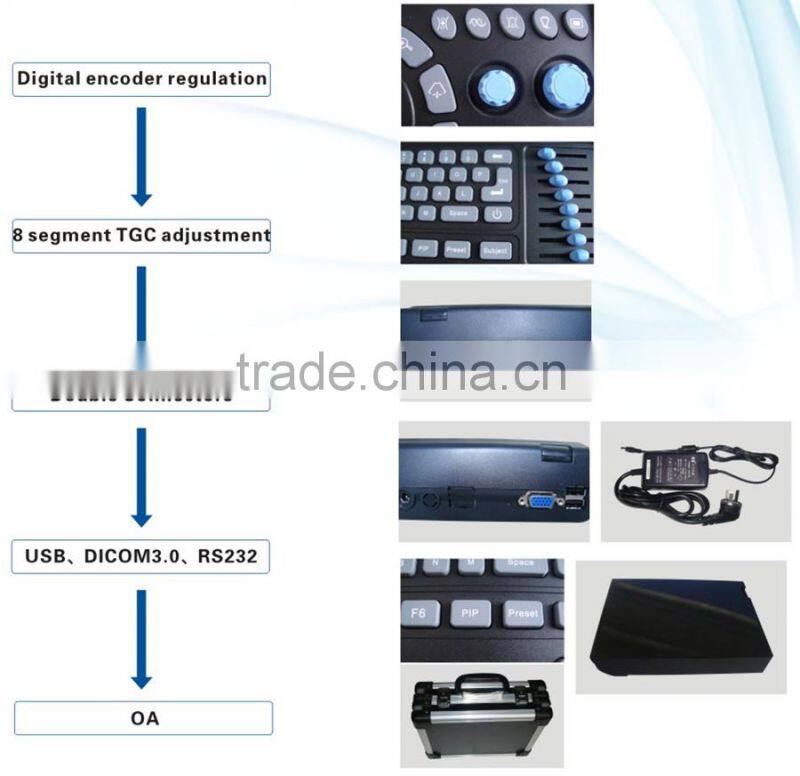 CE approved Laptop PC Ultrasound Scanner /Ultrasonic scanner with 3.5Mhz multi-frequency convex probe RUS-9000E2