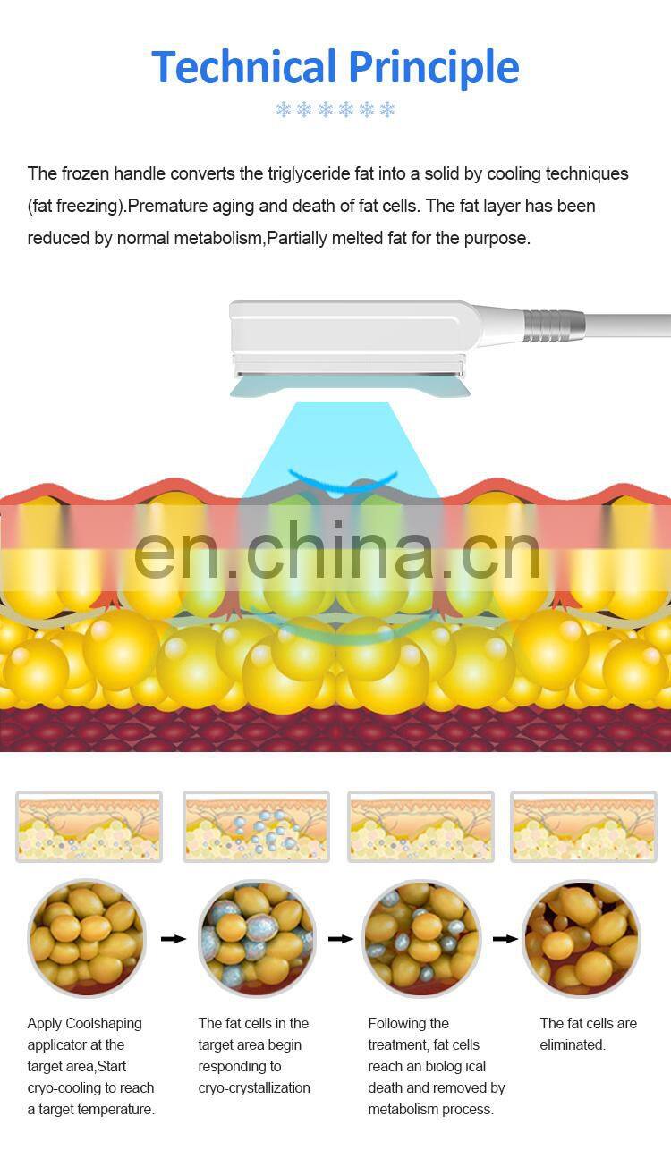 360 Fat Freeze -15 etg50 4s Cyro Fat Freezing Cryolipolysis Equipments