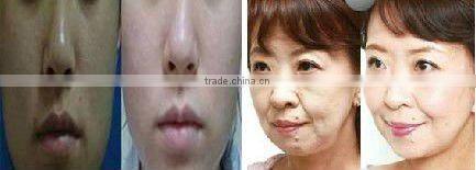 VY-107B Floor Standing Needle Free Injector Skin Reshaper