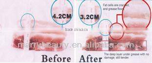 Beauty Product Vacuum RF Roller Cavitation Machine
