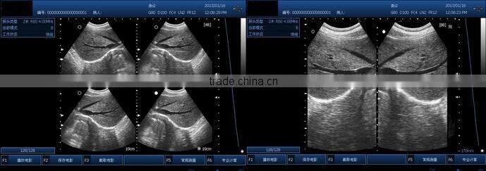 Best Price Pocket Ultrasonic Diagnostic Wireless Ultrasound Probe 10 Years Export Experience Supplier -WBU01