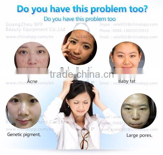 Factory wholesale led facial mask with 3 pdt photon colors 170pcs led lights face mask in stock CE approved