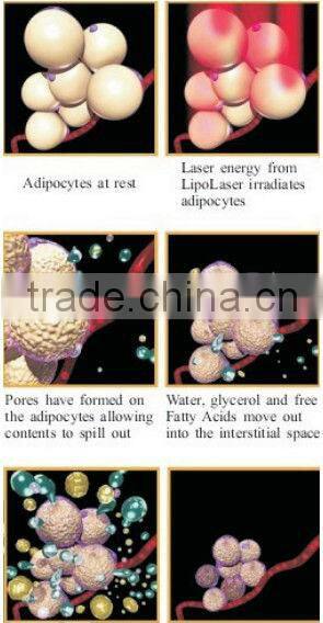 Hot 2013! lipo laser beauty machine Max 130mW beauty machine Max 130mW CE/ISO