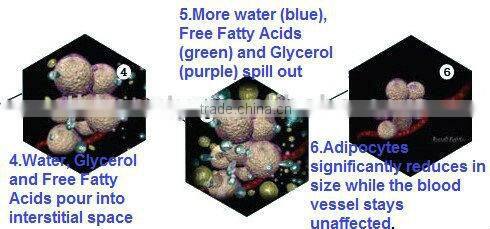 best lipo laser machine for salon