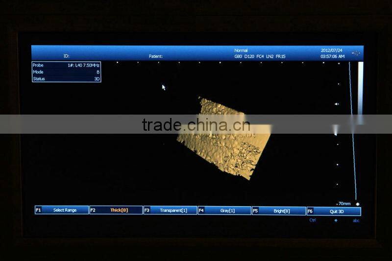 Light weight PC platform 10.4 inch Laptop Ultrasound Scanner with 3.5Mhz Convex probe multi-frequency